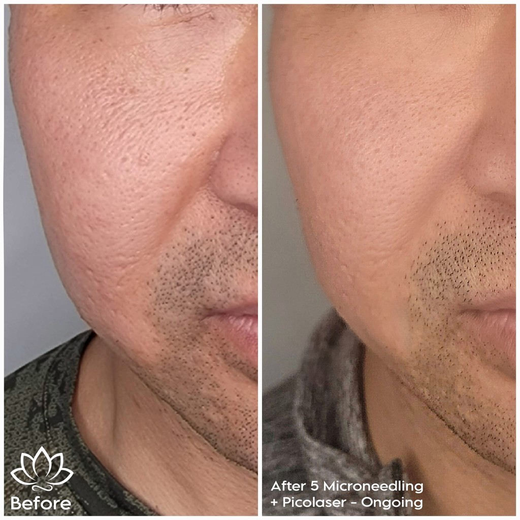 Infinite Glow client result 28