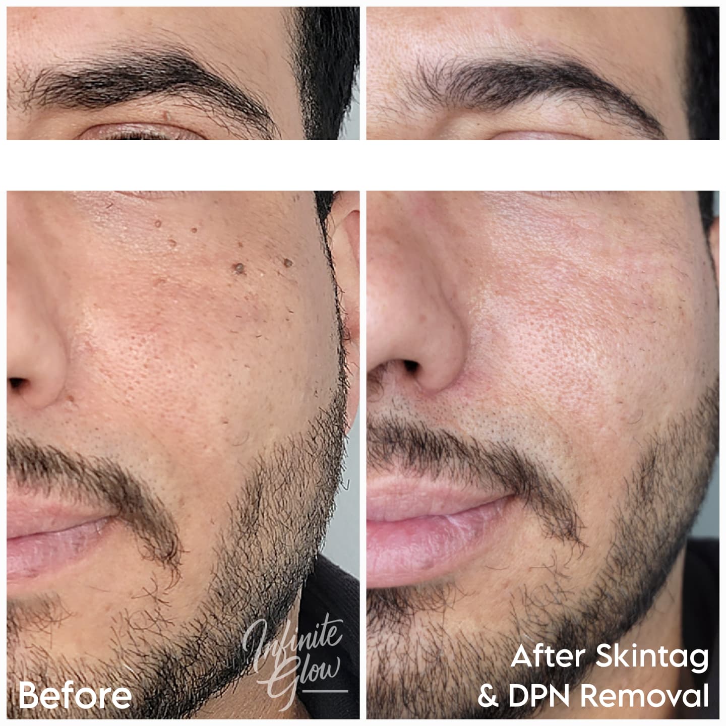 Infinite Glow client result 55